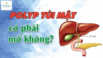 Polyp túi mật, có phải mổ không?