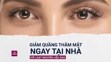 Quầng thâm mắt: Có thể xử lý tại nhà với cách đơn giản, dễ làm này | VTC Now