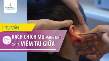 Rạch chích mủ màng nhĩ chữa viêm tai giữa