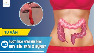 Ruột thừa nằm bên phải hay bên trái ổ bụng?