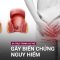 Sa trực tràng: Đừng chủ quan vì bệnh có thể gây biến chứng nguy hiểm | VTC Now