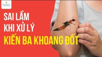 Sai lầm khi xử lý kiến ba khoang đốt| BS Nguyễn Thanh Vân, BV Vinmec Phú Quốc