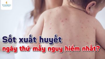 Sốt xuất huyết ngày nào NGUY HIỂM nhất?