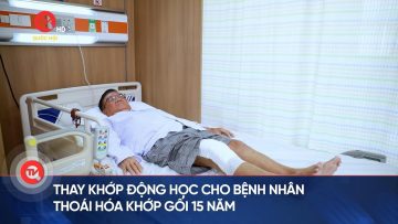 Thay khớp động học cho bệnh nhân thoái hóa khớp gối 15 năm | Truyền hình Quốc hội Việt Nam