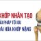 Thay khớp nhân tạo – Giải pháp tối ưu khi thoái hóa khớp nặng