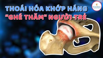 Thoái hóa khớp háng  “ghé thăm người trẻ | BS Phạm Trung Hiếu,, BV Vinmec Times City