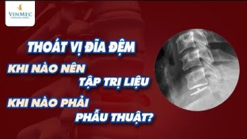 Thoát vị đĩa đệm: Khi nào nên tập trị liệu, khi nào phải phẫu thuật?