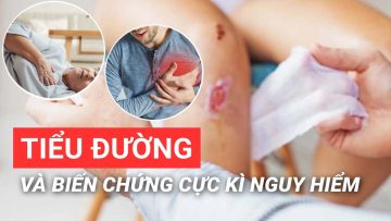 Tiểu đường biến chứng cực kỳ nguy hiểm| BS Võ Hà Băng Sương – Vinmec Phú Quốc