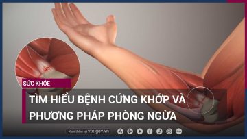 Tìm hiểu bệnh cứng khớp và phương pháp phòng ngừa | VTC Now