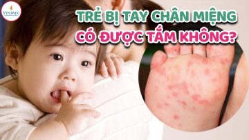 Trẻ bị tay chân miệng có được tắm không?