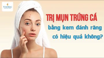 Trị mụn trứng cá bằng kem đánh răng – hiệu quả không?