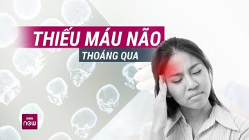 Triệu chứng này cảnh báo một cơn đột quỵ nghiêm trọng có thể đang rình rập bạn | VTC Now