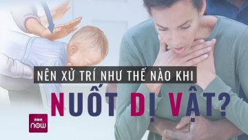 Từ vụ nữ sinh nuốt bàn chải đánh răng 20cm, nên xử trí như thế nào khi nuốt phải dị vật?