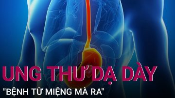 Ung thư dạ dày: Bệnh từ miệng mà ra | VTC Now