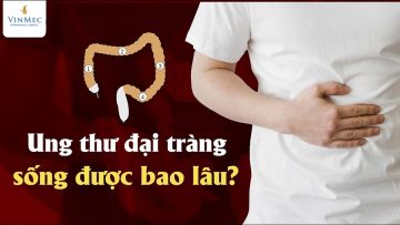 Ung thư đại tràng sống được bao lâu?