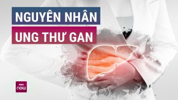 Ung thư gan: Vì sao không nhiều người phát hiện ra bệnh từ giai đoạn sớm? | VTC Now