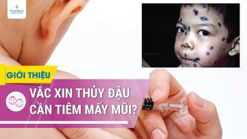 Vacxin thủy đậu cần tiêm mấy mũi?