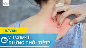 Vì sao bạn bị dị ứng thời tiết?