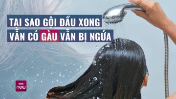 Vì sao một số người càng gội đầu, càng chịu khó chăm sóc da đầu lại càng… gàu và ngứa? | VTC Now