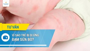 Vì sao trẻ bị dị ứng đạm sữa bò?