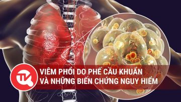 Viêm phổi do phế cầu khuẩn và những biến chứng nguy hiểm ở nhóm người lớn tuổi