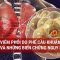 Viêm phổi do phế cầu khuẩn và những biến chứng nguy hiểm ở nhóm người lớn tuổi