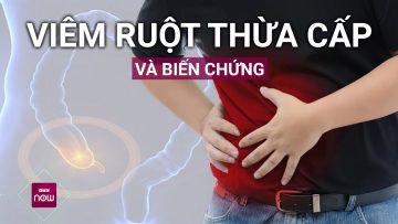 Viêm ruột thừa cấp: Biến chứng khó lường nếu không xử lý kịp thời | VTC Now