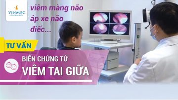 Viêm tai giữa cấp, mạn tính gây biến chứng áp xe não, viêm màng não