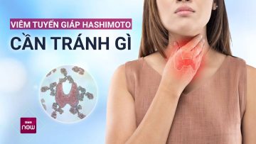 Viêm tuyến giáp Hashimoto: Không nên ăn gì để tránh bị đầu độc mỗi ngày? | VTC Now