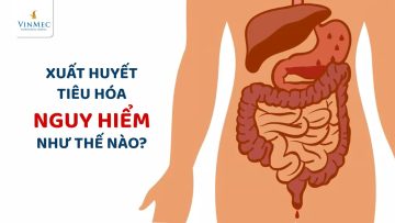 Xuất huyết tiêu hóa nguy hiểm như thế nào?